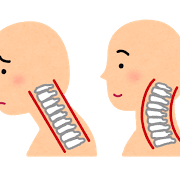 あなたの首は本当に大丈夫？首の痛みはストレートネックが原因かも？